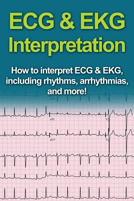 ECG & EKG Interpretation: How to interpret ECG & EKG, including rhythms, arrhythmias, and more! - Paperback