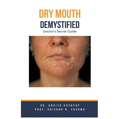 Dry mouth Demystified: Doctor's Secret Guide - Paperback
