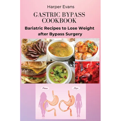 Gastric Bypass Cookbook: Bariatric Recipes to Lose Weight after Bypass Surgery - Paperback