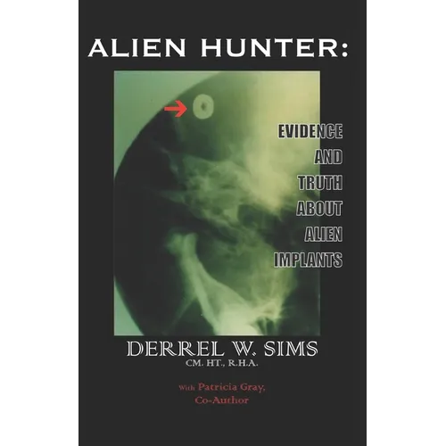 Alien Implants: Evidence & Truth about Alien Implants - Paperback