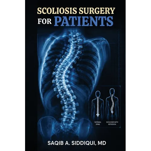 Scoliosis Surgery for Patients - Paperback