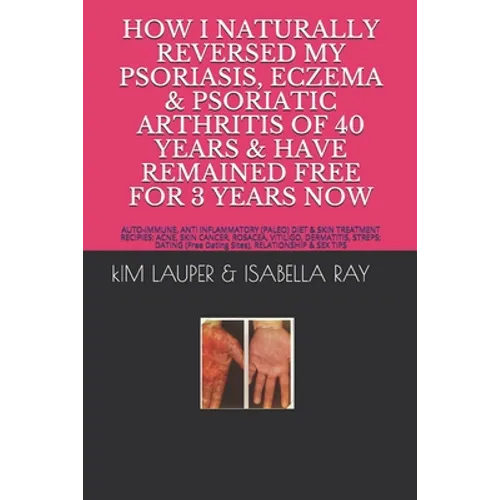 How I Naturally Reversed My Psoriasis, Eczema and Psoriatic Arthritis of 40 Years and Have Remained Free for 3 Years Now: AUTO IMMUNE, GLUTEN FREE, DA - Paperback