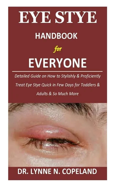 Eye Stye Handbook for Everyone: Detailed Guide on How to Stylishly & Proficiently Treat Eye Stye Quick in Few Days for Toddlers & Adults & So Much Mor - Paperback