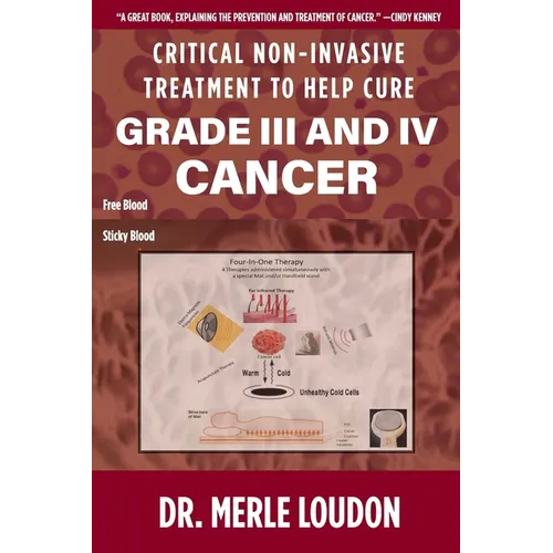 Critical Non-Invasive Treatment to Cure Grade III and IV Cancer - Paperback