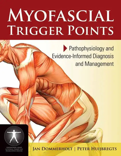 Myofascial Trigger Points: Pathophysiology and Evidence-Informed Diagnosis and Management: Pathophysiology and Evidence-Informed Diagnosis and Managem - Paperback