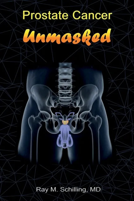 Prostate Cancer Unmasked - Paperback