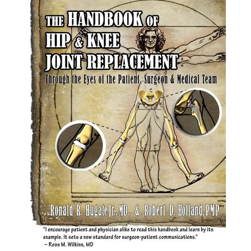 Handbook of Hip & Knee Joint Replacement: Through the Eyes of the Patient, Surgeon & Medical Team - Paperback