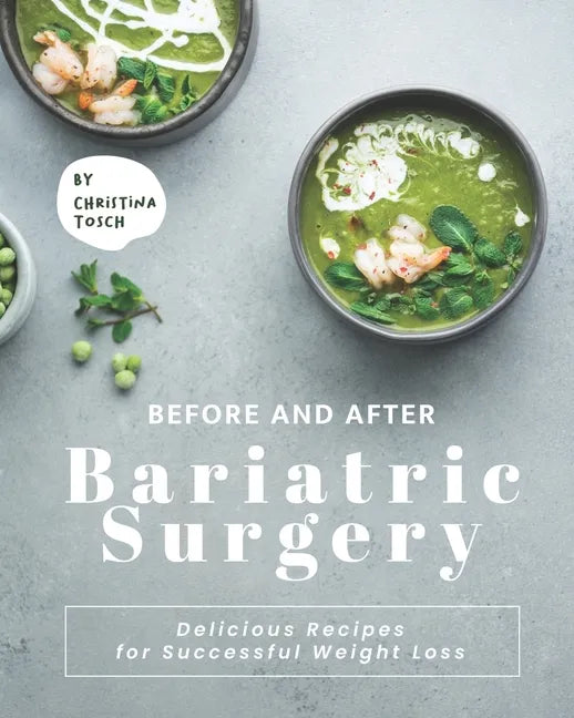 Before and After Bariatric Surgery: Delicious Recipes for Successful Weight Loss - Paperback