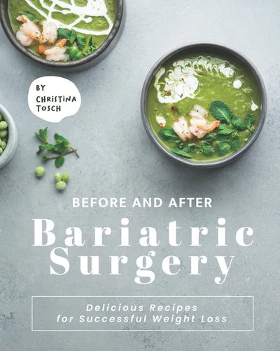 Before and After Bariatric Surgery: Delicious Recipes for Successful Weight Loss - Paperback