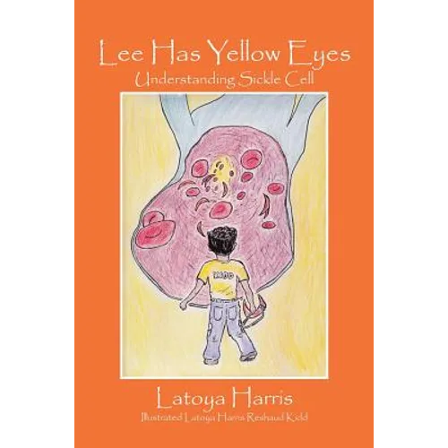 Lee Has Yellow Eyes: Understanding Sickle Cell - Paperback