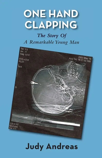 One Hand Clapping - Paperback