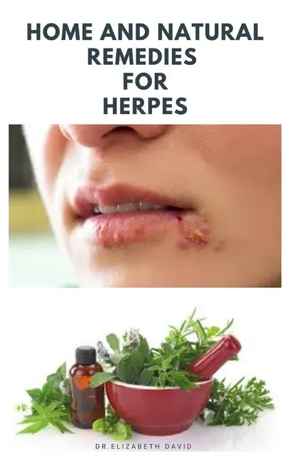 Home and Natural Remedies for Herpes: The Best Herbal And Natural Remedies To Get Rid Of All Form Of Herpes Virus - Paperback