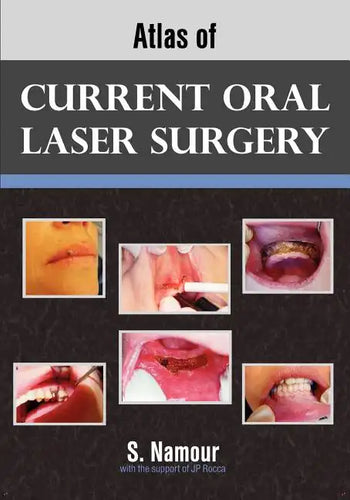 Atlas of Current Oral Laser Surgery - Paperback