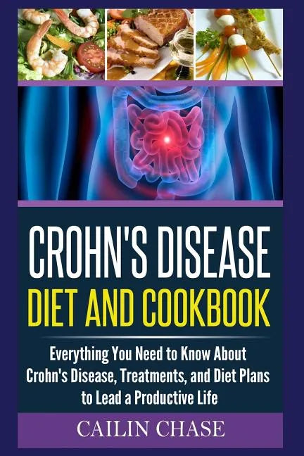 Crohns Disease: The Ultimate Guide For The Treatment and Relief From Crohn's Disease ( Crohns Disease Crohns Cookbook) - Paperback