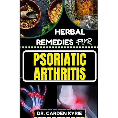 Herbal Remedies for Psoriatic Arthritis: Empower Your Journey To Wellness With Herbs For Alleviating Pain, Restoring Joint Health And Nurturing Overal - Paperback