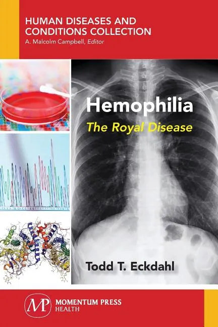 Hemophilia: The Royal Disease - Paperback