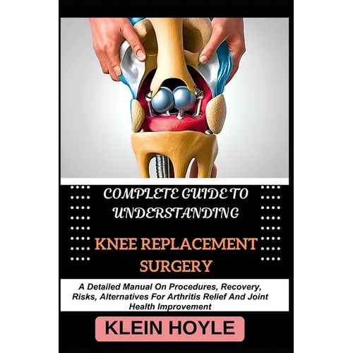 Complete Guide to Understanding Knee Replacement Surgery: A Detailed Manual On Procedures, Recovery, Risks, Alternatives For Arthritis Relief And Join - Paperback