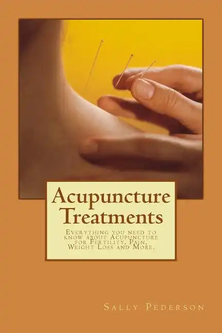 Acupuncture Treatments: Everything You Need to Know about Acupuncture for Fertility, Pain, Weight Loss and More. - Paperback