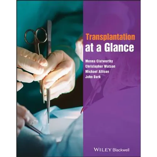 Transplantation at a Glance - Paperback