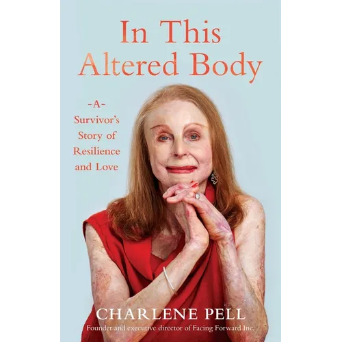 In This Altered Body: A Survivor's Story of Resilience and Love - Paperback