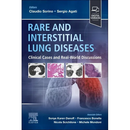 Rare and Interstitial Lung Diseases: Clinical Cases and Real-World Discussions - Paperback