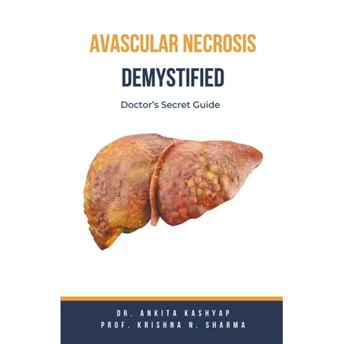 Avascular Necrosis Demystified: Doctor's Secret Guide - Paperback