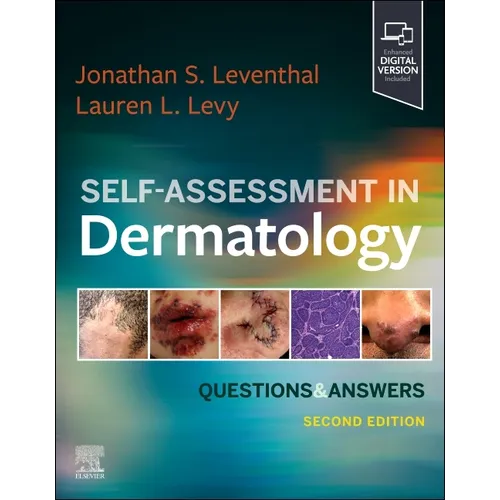 Self-Assessment in Dermatology: Questions and Answers - Paperback