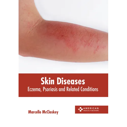 Skin Diseases: Eczema, Psoriasis and Related Conditions - Hardcover