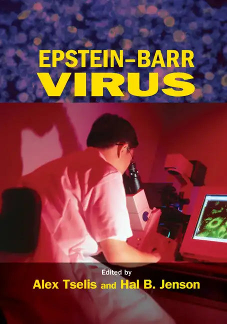 Epstein-Barr Virus - Paperback