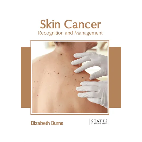 Skin Cancer: Recognition and Management - Hardcover