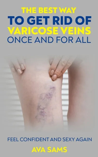 The Best Way to Get Rid of Varicose Veins Once and For All: Feel Confident and Sexy Again: Feel confident and sexy again - Paperback