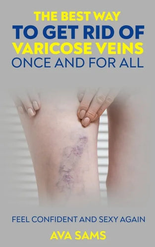 The Best Way to Get Rid of Varicose Veins Once and For All: Feel Confident and Sexy Again: Feel confident and sexy again - Paperback