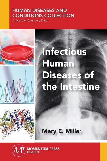 Infectious Human Diseases of the Intestine - Paperback