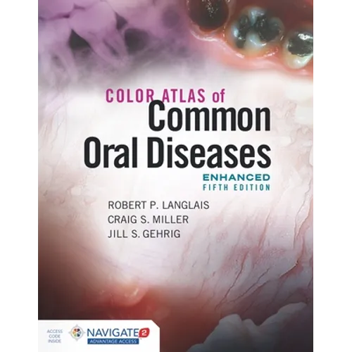 Color Atlas of Common Oral Diseases, Enhanced Edition - Paperback