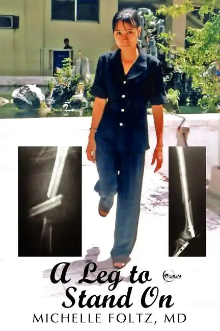 A Leg to Stand On - Paperback