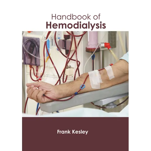 Handbook of Hemodialysis - Hardcover