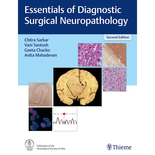 Essentials of Diagnostic Surgical Neuropathology - Hardcover