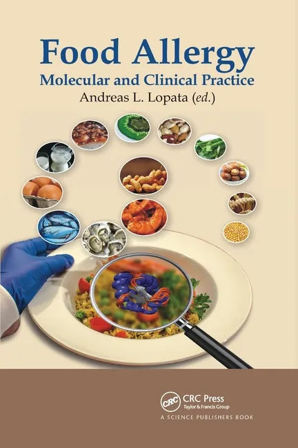 Food Allergy: Molecular and Clinical Practice - Paperback