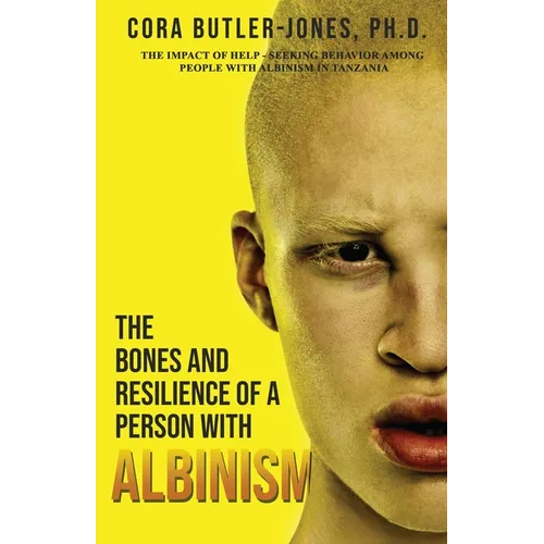 The Bones and Resilience of a Person with Albinism - Paperback
