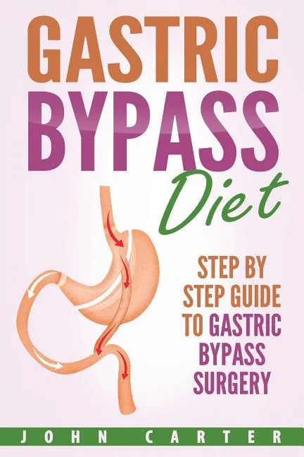 Gastric Bypass Diet: Step By Step Guide to Gastric Bypass Surgery - Paperback