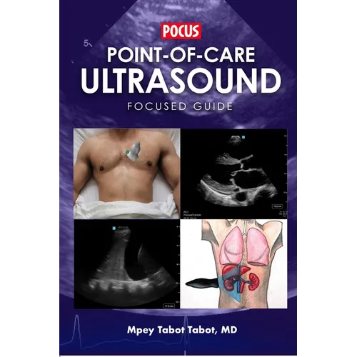 Point-Of-Care Ultrasound Focused Guide - Paperback