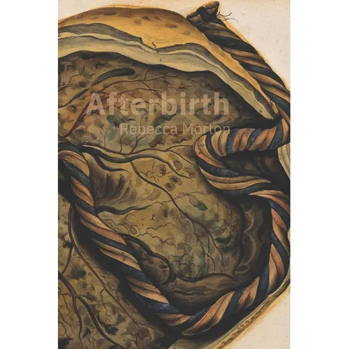 Afterbirth - Paperback
