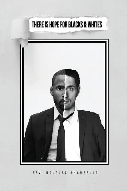 There Is Hope for Blacks & Whites - Paperback