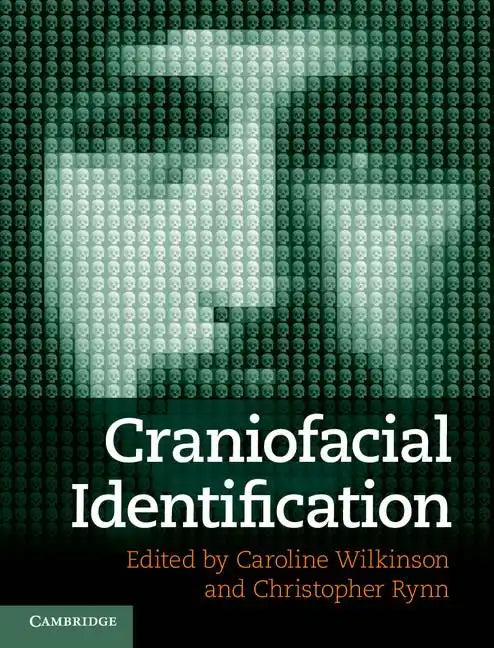 Craniofacial Identification - Hardcover