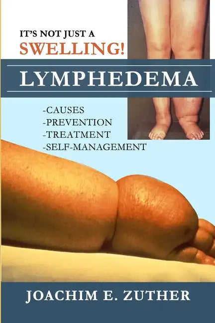 It's Not Just a Swelling! Lymphedema: Causes, Prevention, Treatment, Self-Management - Paperback
