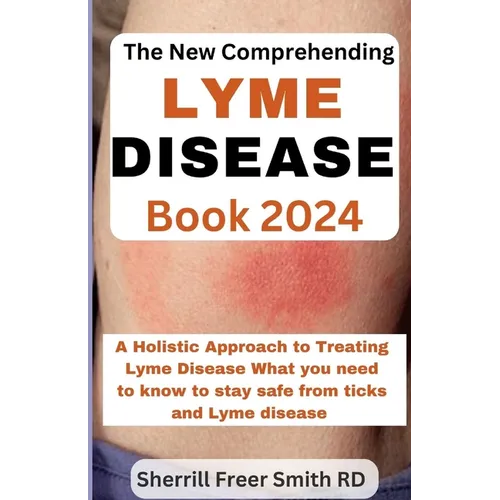 The New Comprehending Lyme Disease Book 2024: A Holistic Approach to Treating Lyme Disease What you need to know to stay safe from ticks and Lyme dise - Paperback
