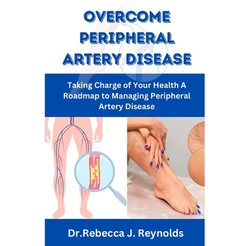 Overcome Peripheral Artery Disease: Taking Charge of Your Health A Roadmap to Managing Peripheral Artery Disease - Paperback