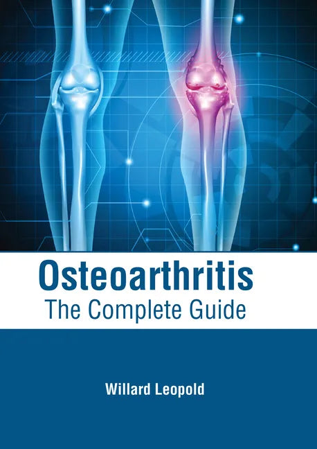 Osteoarthritis: The Complete Guide - Hardcover