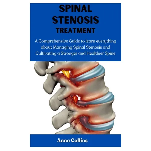 Spinal Stenosis Treatment: A Comprehensive Guide to learn everything about Managing Spinal Stenosis and Cultivating a Stronger and Healthier Spin - Paperback