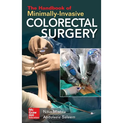 The Handbook of Minimally-Invasive Colorectal Surgery - Paperback